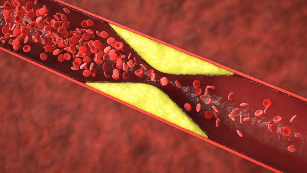 Blood Vessels